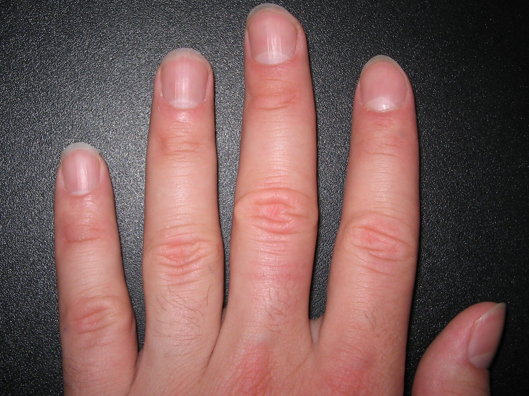 The Spiritual Significance of Fingernails in the Bible John Baptist